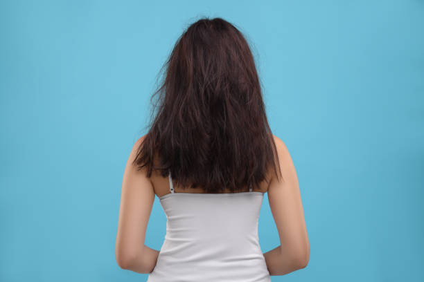 Woman with damaged hair on light blue background, back view